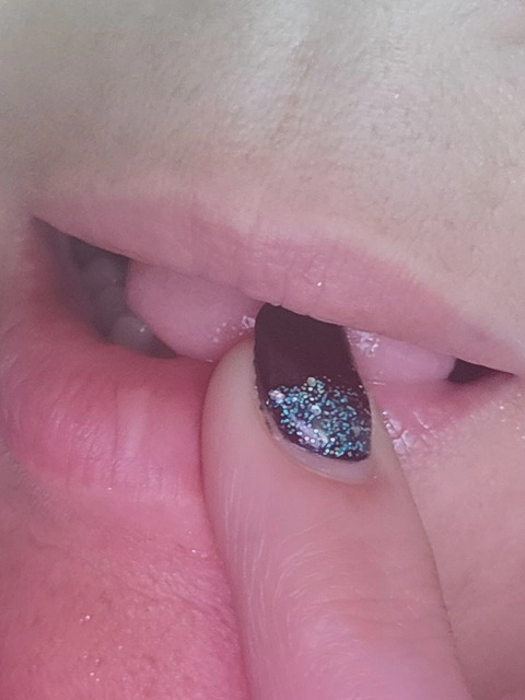 Nudey Lips OnlyFans Picture