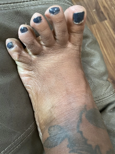 Ugly feet