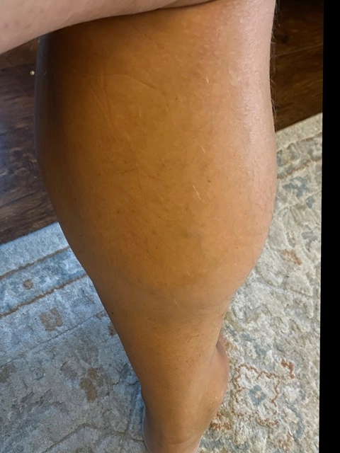 Giant Calves OnlyFans Picture