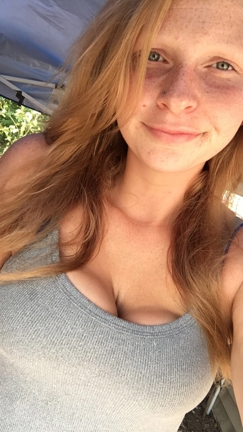 Freckles