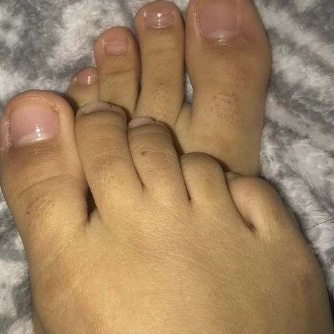 Phalanges Only 🦶 OnlyFans Picture