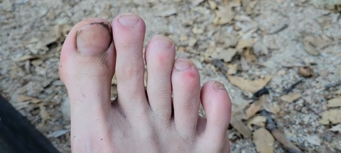 FEET OF THE PCT