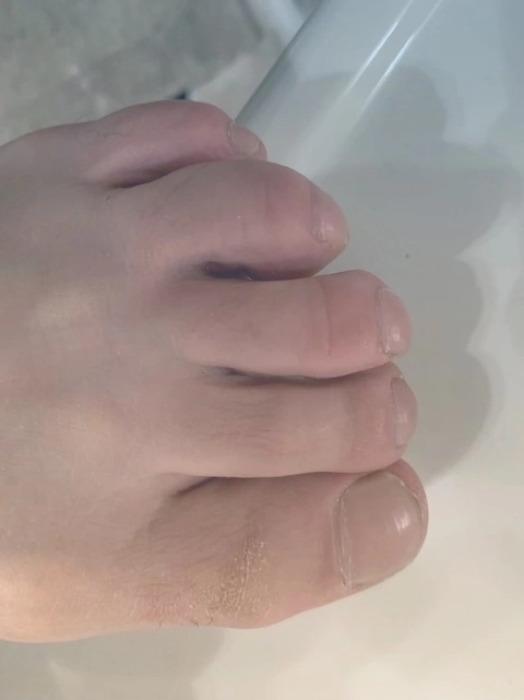 My Thick Toes
