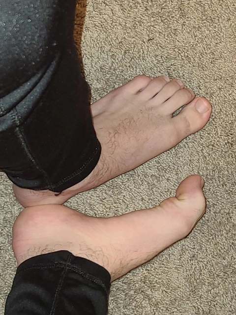 That One Foot Dude OnlyFans Picture