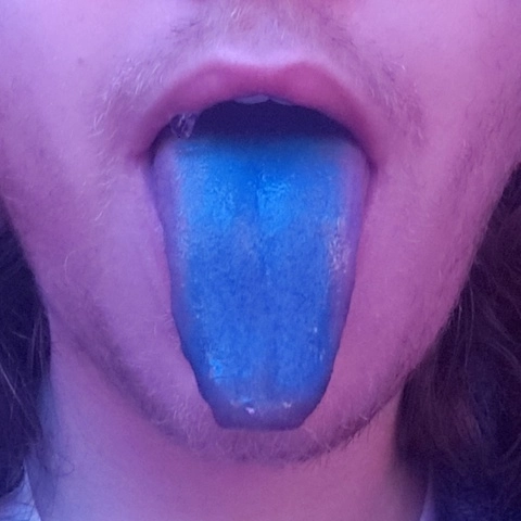 Blue Tongued Skank